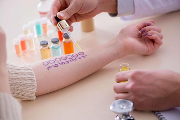 Prick-Test Allergietest auf der Haut