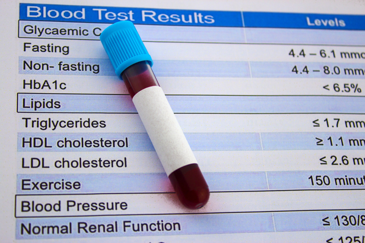 Making sense of cholesterol tests - Harvard Health